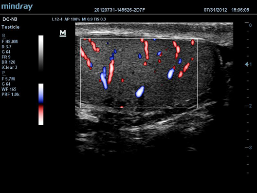 Testicle HR Color Flow